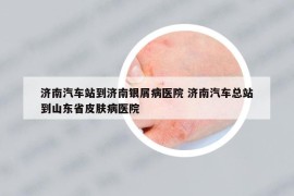 济南汽车站到济南银屑病医院 济南汽车总站到山东省皮肤病医院