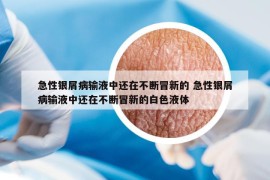 急性银屑病输液中还在不断冒新的 急性银屑病输液中还在不断冒新的白色液体