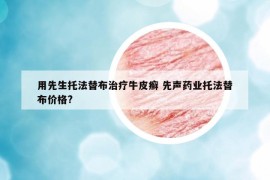 用先生托法替布治疗牛皮癣 先声药业托法替布价格?