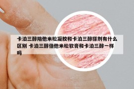 卡泊三醇陪他米松凝胶和卡泊三醇搽剂有什么区别 卡泊三醇倍他米松软膏和卡泊三醇一样吗