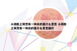 小孩脸上突然有一块白的是什么意思 小孩脸上突然有一块白的是什么意思图片