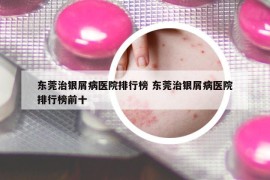 东莞治银屑病医院排行榜 东莞治银屑病医院排行榜前十