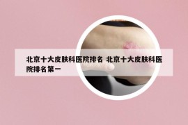北京十大皮肤科医院排名 北京十大皮肤科医院排名第一