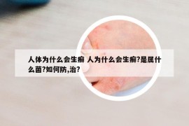 人体为什么会生癣 人为什么会生癣?是属什么菌?如何防,治?