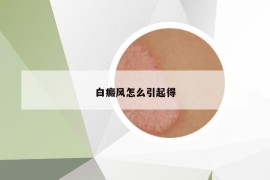 白癜风怎么引起得