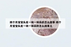 四个月宝宝头皮一块一块白的怎么回事 四个月宝宝头皮一块一块白的怎么回事儿