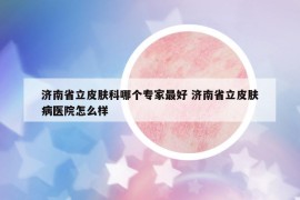 济南省立皮肤科哪个专家最好 济南省立皮肤病医院怎么样