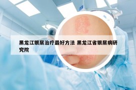 黑龙江银屑治疗最好方法 黑龙江省银屑病研究院