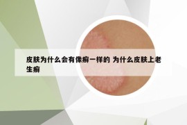 皮肤为什么会有像癣一样的 为什么皮肤上老生癣