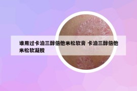 谁用过卡泊三醇倍他米松软膏 卡泊三醇倍他米松软凝胶