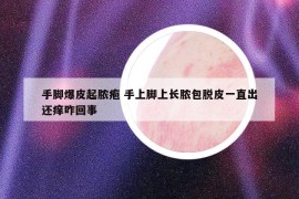 手脚爆皮起脓疱 手上脚上长脓包脱皮一直出还痒咋回事