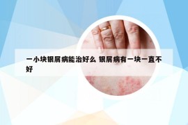 一小块银屑病能治好么 银屑病有一块一直不好