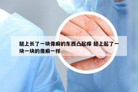 腿上长了一块像癣的东西凸起痒 腿上起了一块一块的像癣一样