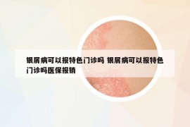 银屑病可以报特色门诊吗 银屑病可以报特色门诊吗医保报销