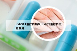 uvb311治疗白癜风 uvb灯治疗白斑的费用