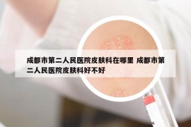 成都市第二人民医院皮肤科在哪里 成都市第二人民医院皮肤科好不好