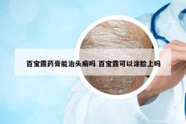 百宝露药膏能治头癣吗 百宝露可以涂脸上吗