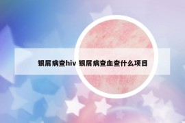 银屑病查hiv 银屑病查血查什么项目