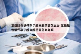 掌指脓包病怀孕了越来越厉害怎么办 掌指脓包病怀孕了越来越厉害怎么办呢