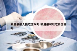 银屑病病人能吃玉米吗 银屑病可以吃白玉菇吗