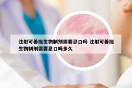 注射可善挺生物制剂需要忌口吗 注射可善挺生物制剂需要忌口吗多久