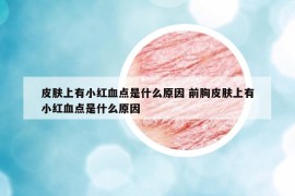 皮肤上有小红血点是什么原因 前胸皮肤上有小红血点是什么原因