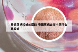 看银屑病较好的医院 看银屑病去哪个医院会比较好