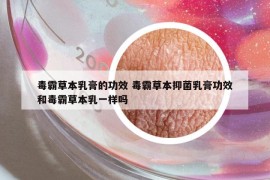 毒霸草本乳膏的功效 毒霸草本抑菌乳膏功效和毒霸草本乳一样吗