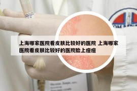 上海哪家医院看皮肤比较好的医院 上海哪家医院看皮肤比较好的医院脸上痘痘