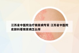 江苏省中医院治疗银屑病专家 江苏省中医院皮肤科看银屑病怎么样