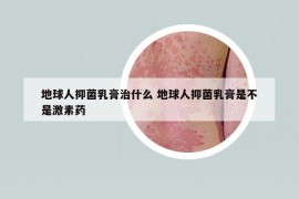 地球人抑菌乳膏治什么 地球人抑菌乳膏是不是激素药