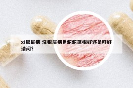 xi银屑病 洗银屑病用驼驼蓬根好还是籽好请问?