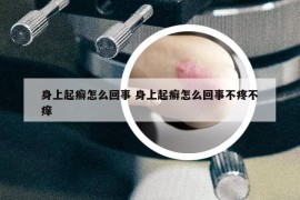 身上起癣怎么回事 身上起癣怎么回事不疼不痒