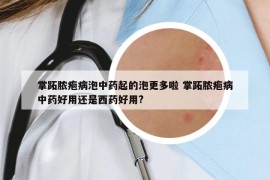 掌跖脓疱病泡中药起的泡更多啦 掌跖脓疱病中药好用还是西药好用?