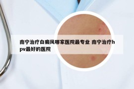 南宁治疗白癜风哪家医院最专业 南宁治疗hpv最好的医院