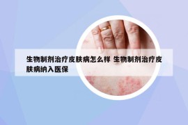 生物制剂治疗皮肤病怎么样 生物制剂治疗皮肤病纳入医保