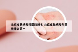 北京皮肤病专科医院排名 北京皮肤病专科医院排名第一
