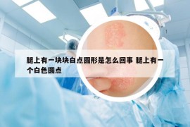 腿上有一块块白点圆形是怎么回事 腿上有一个白色圆点