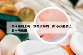 孩子胳膊上有一块类似癣的一片 小孩胳膊上有一块像癣