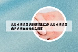 急性点滴银屑病消退期出红疹 急性点滴银屑病消退期出红疹怎么回事