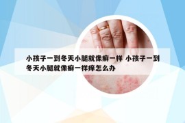 小孩子一到冬天小腿就像癣一样 小孩子一到冬天小腿就像癣一样痒怎么办