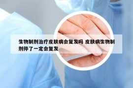 生物制剂治疗皮肤病会复发吗 皮肤病生物制剂停了一定会复发