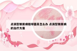 点滴型银屑病链球菌高怎么办 点滴型银屑病的治疗方案