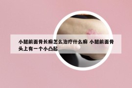 小腿前面骨长癣怎么治疗什么癣 小腿前面骨头上有一个小凸起