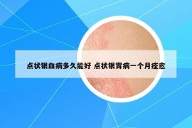 点状银血病多久能好 点状银霄病一个月痊愈