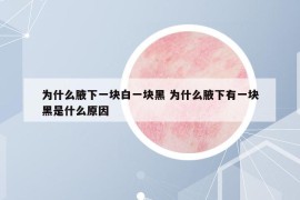 为什么腋下一块白一块黑 为什么腋下有一块黑是什么原因