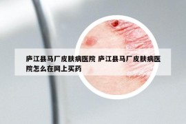 庐江县马厂皮肤病医院 庐江县马厂皮肤病医院怎么在网上买药