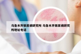 乌鲁木齐银屑病研究所 乌鲁木齐银屑病研究所地址电话