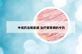 中成药治银属病 治疗银霄病的中药