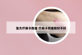 复方疗癣卡西甫 疗癣卡西甫散好不好